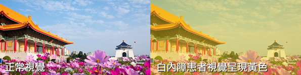 信合美專業、安全的視力治療