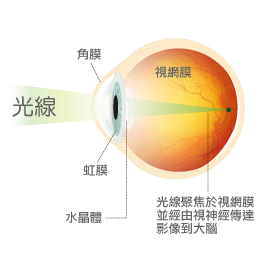 信合美專業、安全的視力治療