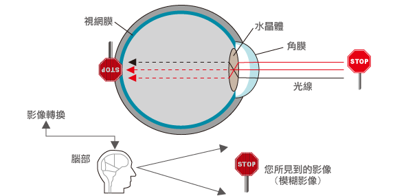 信合美專業、安全的視力治療