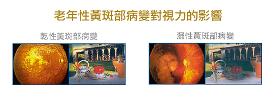 信合美專業、安全的視力治療