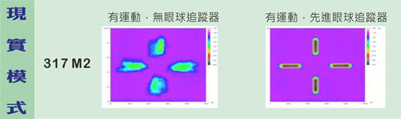 準分子近視雷射,lasik