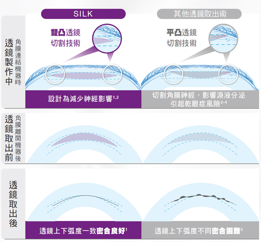 準分子近視雷射,lasik